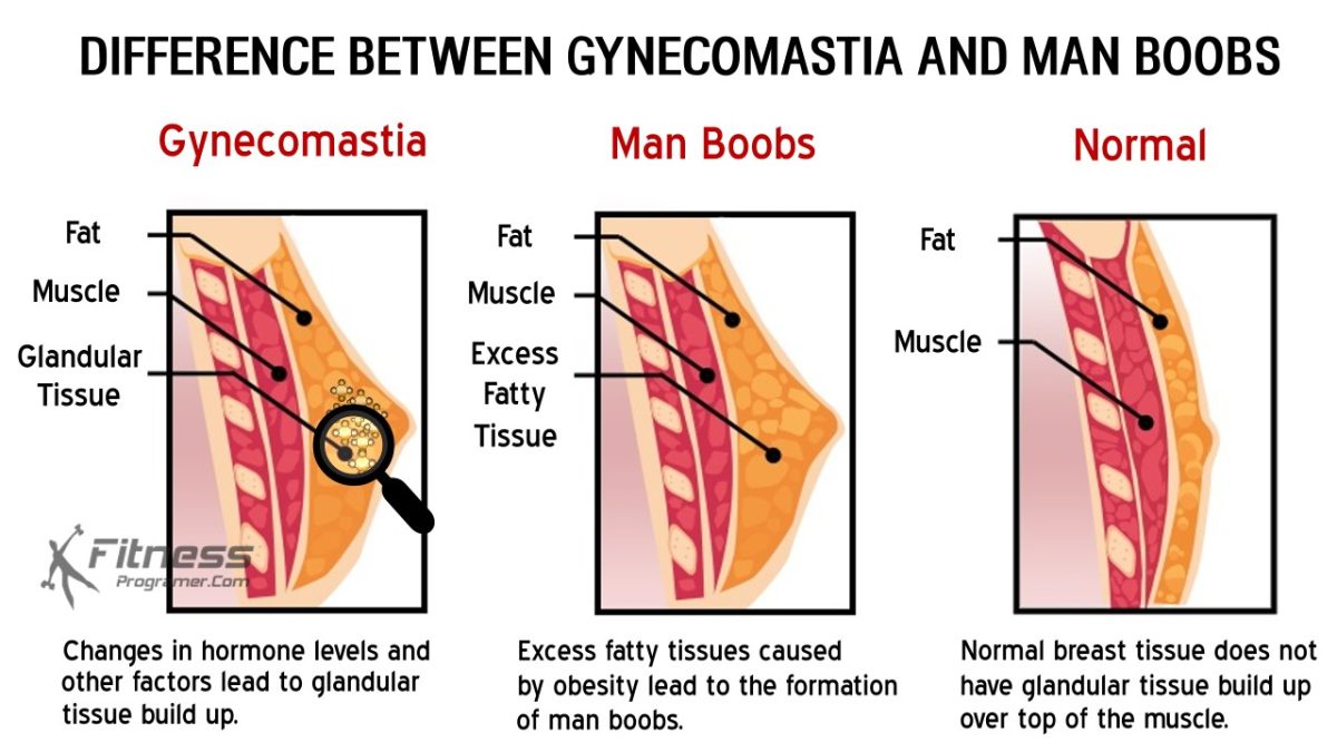 What Causes Man Boobs & How Do You Get Rid Of Them?